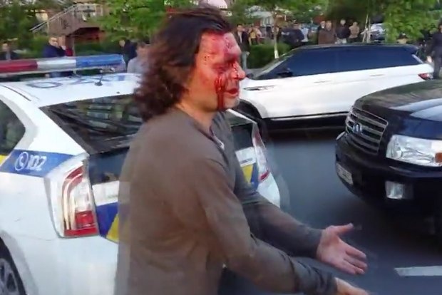 В Киеве полиция при задержании разбила голову водителю